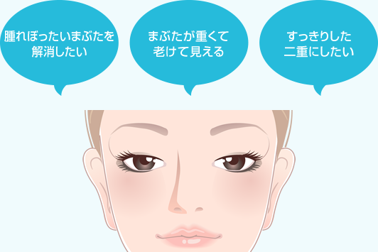 腫れぼったいまぶたを解消したい　まぶたが重くて老けて見える　すっきりした二重にしたい