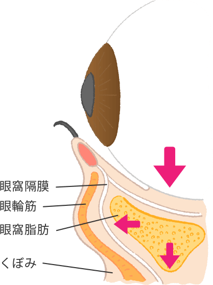 目の下のクマ・たるみの原因