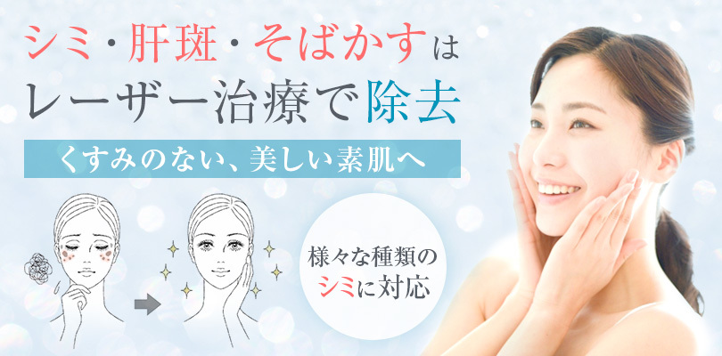 名古屋 大阪梅田でシミ取り エースクリニック しみ 肝斑 そばかす治療 美容外科 美容皮膚科
