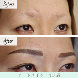 名古屋で医療アートメイクなら エースクリニック 眉 アイライン リップ 美容形成外科 美容皮膚科