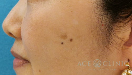 症例紹介一覧 エースクリニック 名古屋 大阪梅田 美容外科 美容整形 名古屋の