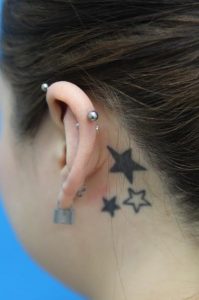 レーザーによるタトゥー除去　耳の後ろの症例　治療前