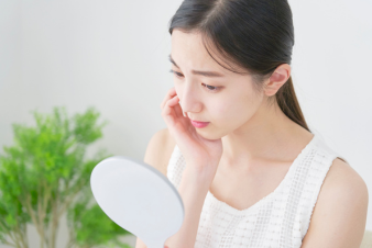 シミが取れない女性