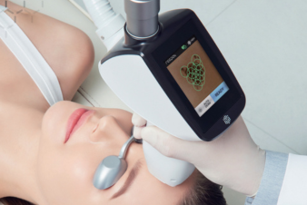 スキャナー照射機能